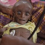 a-7-month-old-is-held-by-his-mother-at-a-rescue-center-in-kenya