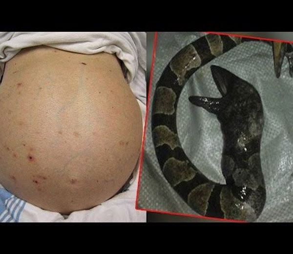 वायरल हुईं Photos महिला ने जन्म दिया एक सांप जैसे जीव को देखे फोटोज