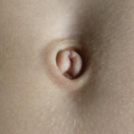 cropped-belly-button-navel-hindi-nabhi.png