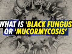What is Black Fungus in Hindi, Symptoms, Precautions & Treatment All Details, Black Fungus Kya Hai, ब्लैक फंगस क्या है? लक्षण क्या है ? और कैसे बच सकते है ? क्या हमें डरना चाहिए ?