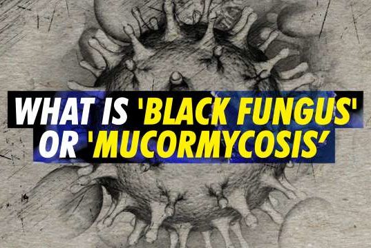 What is Black Fungus in Hindi, Symptoms, Precautions & Treatment All Details, Black Fungus Kya Hai, ब्लैक फंगस क्या है? लक्षण क्या है ? और कैसे बच सकते है ? क्या हमें डरना चाहिए ?