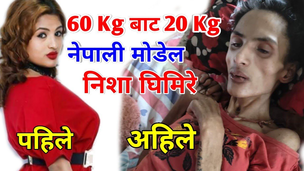 Nepali Famous Actress & Model Nisha Ghimire Accident Death Live News in Hindi, Who is Nisha Ghimire Wiki, Bio, Pics, Age, Family, Instagram | निशा घिमिरे एक्सीडेंट,