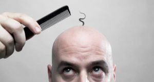 Best Collection of Hair Loss (Hair Fall) Shayari Status Quotes Slogans Images in Hindi for Boys & Girls | बाल झड़ने (हेयर फॉल) पर शायरी स्टेटस कोट्स स्लोगन हिंदी में