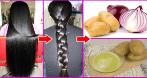 Hair Loss and Onion, Onion For Regrowth of Hair, Onion For Hair Fall, Onion Juice Hair Regrowth, Onion For Hair Loss, Onion Juice For Hair Loss, Mamaearth Hair Fall Kit, Onion Juice For Hair Fall