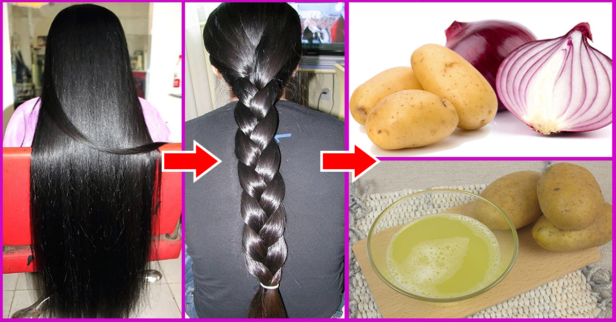 Hair Loss and Onion, Onion For Regrowth of Hair, Onion For Hair Fall, Onion Juice Hair Regrowth, Onion For Hair Loss, Onion Juice For Hair Loss, Mamaearth Hair Fall Kit, Onion Juice For Hair Fall