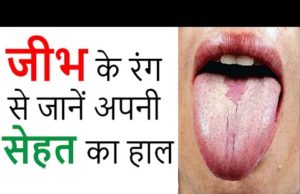 Tongue Color: Know the condition of your health by the color of the tongue