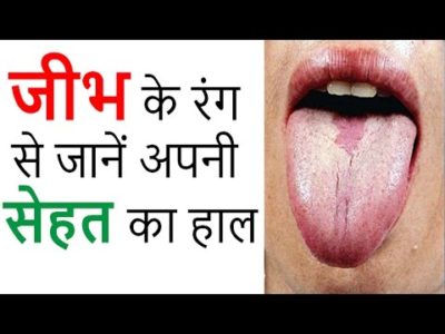 Tongue Color: Know the condition of your health by the color of the tongue
