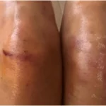 Nyra Banerjee Injured in ‘Khatron Ke Khiladi 13’