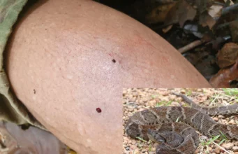 In Madhya Pradesh, three people of the same family were bitten by a snake, mother and daughter died | MP Snake Bite Case News in Hindi | एक ही परिवार के तीन लोगों को सांप ने काटा, मां-बेटी की मौत; बेटे की हालत नाजुक